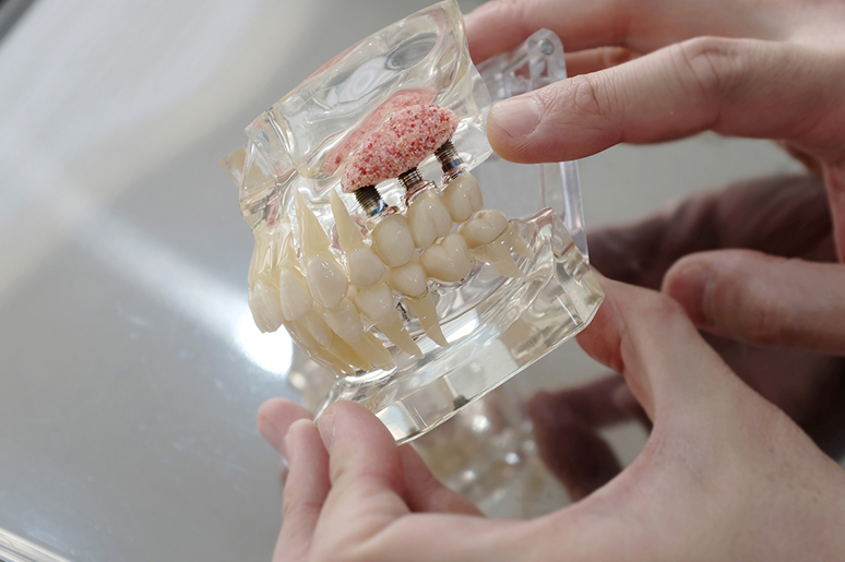 Bone graft material types for dental implants