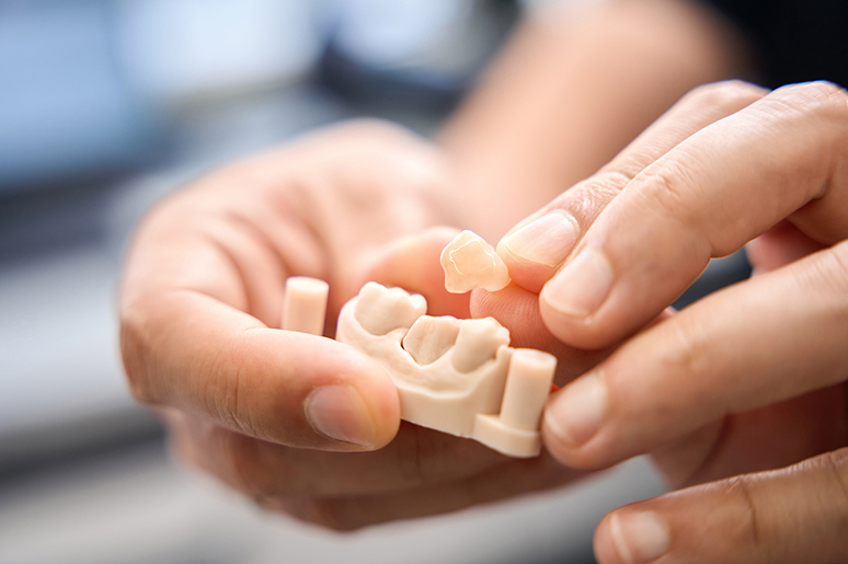 CEREC crown milling process at Trusted Dental