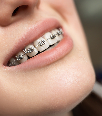 Gum disease treatment at Trusted Dental Hawthorne CA