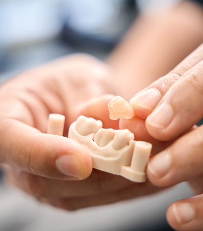 Dental Crowns